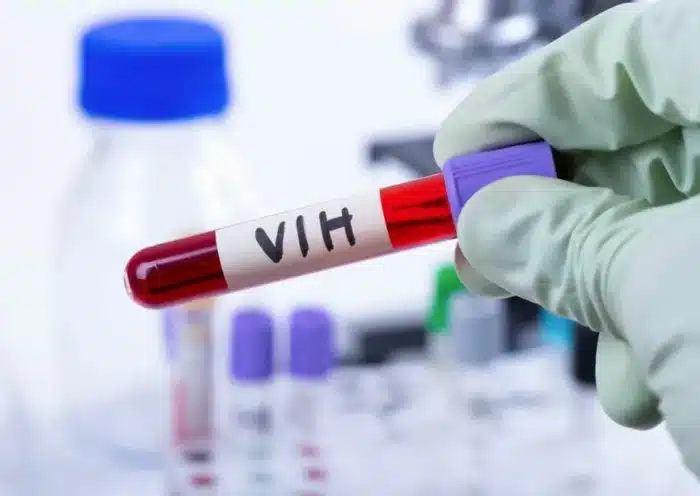 Prévention du VIH : l’OMS recommande un antirétroviral injectable deux fois par an