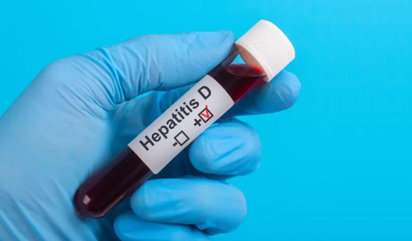 Hépatite : le type D désormais classé comme cancérogène, selon l’OMS