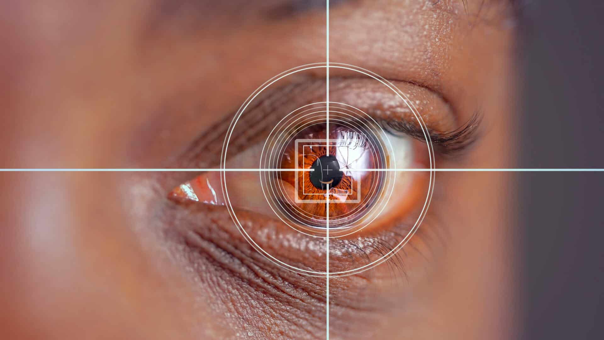 Santé oculaire au Bénin : une campagne gratuite de dépistage et de traitement de la cataracte lancée à Allada