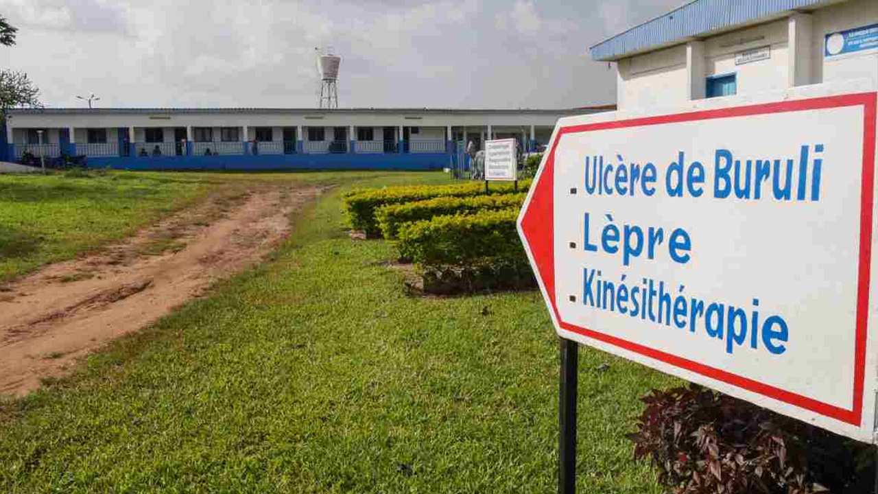 CDTLUB de Pobê : deux décennies d’impact sanitaire aux côtés de la Fondation Raoul Follereau